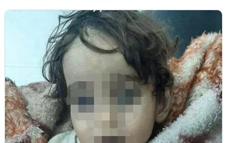 Un'immagine, tratta dal profilo Twitter di Syrian Network, di Iman Mahmoud Laila, morta assiderata a un anno e mezzo tra le braccia del padre che cercava di portarla a piedi in ospedale da un campo profughi improvvisato a Idlib, 14 febbraio 2020.  ANSA / Immagine tratta dal profilo Twitter di Syrian Network   +++ATTENZIONE LA FOTO NON PUO' ESSERE PUBBLICATA O RIPRODOTTA SENZA L'AUTORIZZAZIONE DELLA FONTE DI ORIGINE CUI SI RINVIA+++   ++NO SALES; NO ARCHIVE; EDITORIAL USE ONLY++