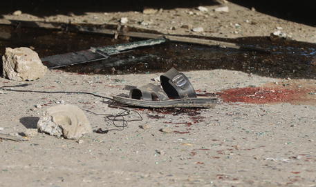 epa08454242 Belongings of victims of a shuttle minibus explosion in downtown Kabul, Afghanistan, 30 May 2020. According to the police officials, two people were killed, including a local TV reporter, and six others were injured in a roadside bomb blast.  EPA/JAWAD JALALI
