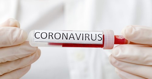 28092020 Cina e coronavirus